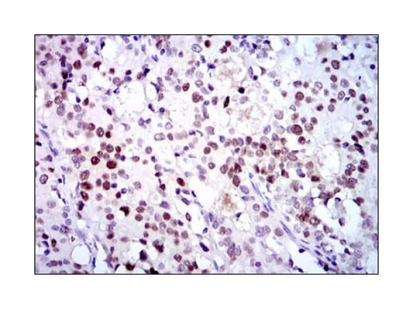 aladdin 阿拉丁 Ab095749 CDK2 Mouse mAb mAb(1A6); Mouse anti human CDK2 antibody; WB, IHC, ICC/IF, Flow, ELISA; Unconjugated