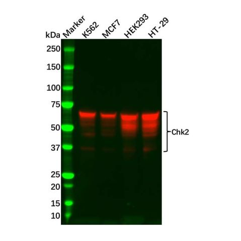 aladdin 阿拉丁 Ab096333 Recombinant Chk2 Antibody Recombinant (R06-1B4); Rabbit anti Human Chk2 Antibody; WB, ICC, IF; Unconjugated