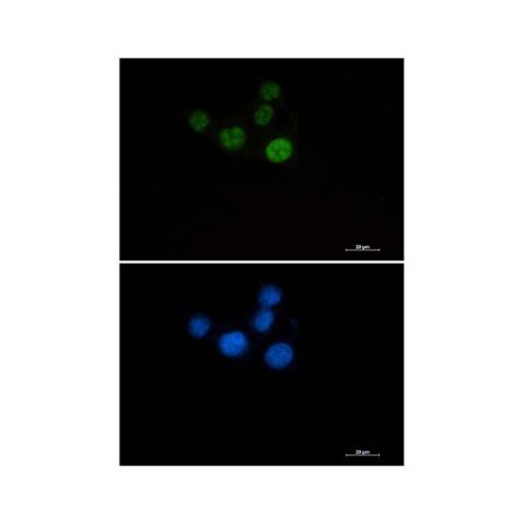 aladdin 阿拉丁 Ab096333 Recombinant Chk2 Antibody Recombinant (R06-1B4); Rabbit anti Human Chk2 Antibody; WB, ICC, IF; Unconjugated