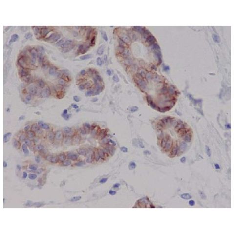 aladdin 阿拉丁 Ab096640 Recombinant c-Kit Antibody Recombinant (R08-1F9); Rabbit anti Human c-Kit Antibody; WB, IHC; Unconjugated