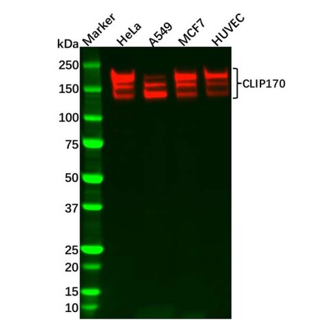 aladdin 阿拉丁 Ab096865 Recombinant CLIP170 Antibody Recombinant (R07-1F3); Rabbit anti Human CLIP170 Antibody; WB, IHC, ICC, IF; Unconjugated