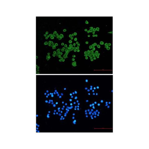 aladdin 阿拉丁 Ab096865 Recombinant CLIP170 Antibody Recombinant (R07-1F3); Rabbit anti Human CLIP170 Antibody; WB, IHC, ICC, IF; Unconjugated