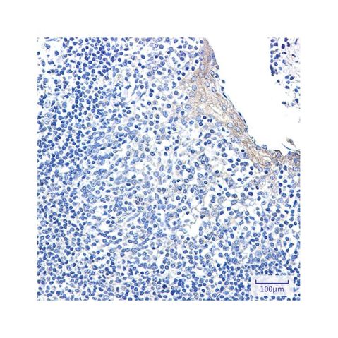 aladdin 阿拉丁 Ab096865 Recombinant CLIP170 Antibody Recombinant (R07-1F3); Rabbit anti Human CLIP170 Antibody; WB, IHC, ICC, IF; Unconjugated