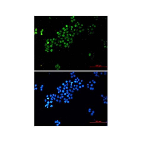 aladdin 阿拉丁 Ab097003 Recombinant c-Myc Antibody Recombinant (R05-5E2); Rabbit anti Human c-Myc Antibody; WB, IF, ICC; Unconjugated