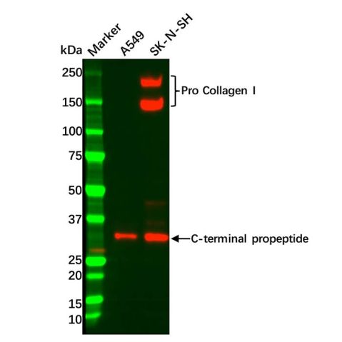 aladdin 阿拉丁 Ab097170 Collagen I Antibody pAb; Rabbit anti Human Collagen I Antibody; WB; Unconjugated
