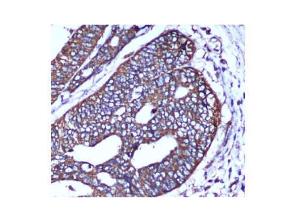 aladdin 阿拉丁 Ab097414 COX IV Mouse mAb mAb (4D11-B3-E8); Mouse anti Human COX IV Antibody; WB, IHC, ICC, IF, Flow, IP; Unconjugated