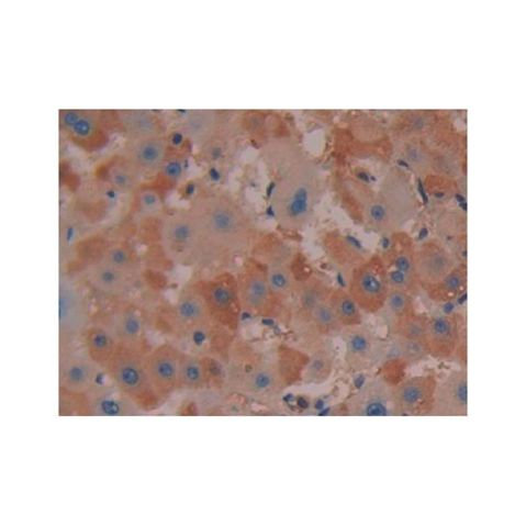 aladdin 阿拉丁 Ab097432 COX2 Antibody pAb; Rabbit anti Human COX2 Antibody; WB, IHC; Unconjugated