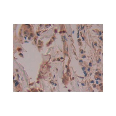 aladdin 阿拉丁 Ab097432 COX2 Antibody pAb; Rabbit anti Human COX2 Antibody; WB, IHC; Unconjugated