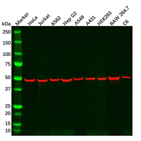 aladdin 阿拉丁 Ab097670 Recombinant CREB Antibody Recombinant (R08-4H9); Rabbit anti Human CREB Antibody; WB, IHC; Unconjugated