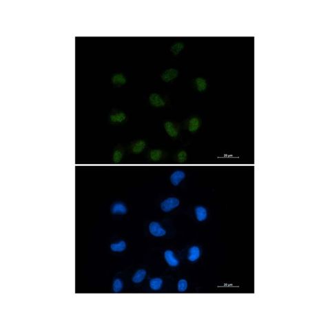 aladdin 阿拉丁 Ab098022 Recombinant CtBP1 Antibody Recombinant (R06-4A3); Rabbit anti Human CtBP1 Antibody; WB, IHC, IF, ICC; Unconjugated