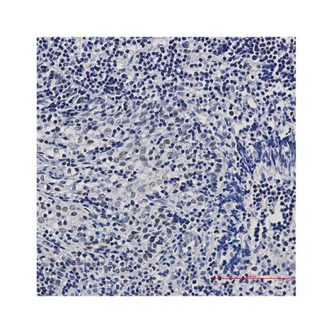 aladdin 阿拉丁 Ab098022 Recombinant CtBP1 Antibody Recombinant (R06-4A3); Rabbit anti Human CtBP1 Antibody; WB, IHC, IF, ICC; Unconjugated