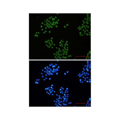 aladdin 阿拉丁 Ab098025 Recombinant CTBP2 Antibody Recombinant (R02-7A0); Rabbit anti Human CTBP2 Antibody; WB, IHC, IF, ICC; Unconjugated