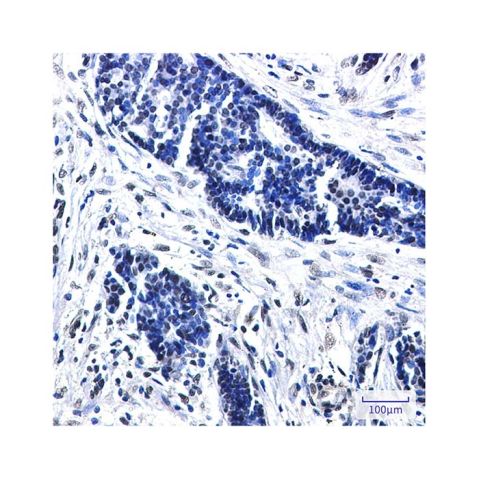 aladdin 阿拉丁 Ab098025 Recombinant CTBP2 Antibody Recombinant (R02-7A0); Rabbit anti Human CTBP2 Antibody; WB, IHC, IF, ICC; Unconjugated