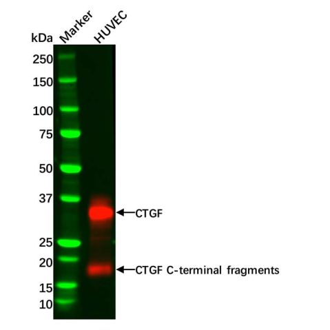 aladdin 阿拉丁 Ab098051 Recombinant CTGF Antibody Recombinant (R08-8C2); Rabbit anti Human CTGF Antibody; WB; Unconjugated