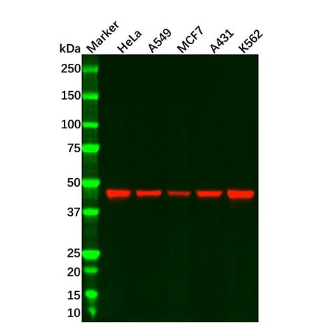 aladdin 阿拉丁 Ab098427 Recombinant Cyclin B2/CCNB2 Antibody Recombinant (R08-1H8); Rabbit anti Human CCNB2 Antibody; WB, IHC; Unconjugated