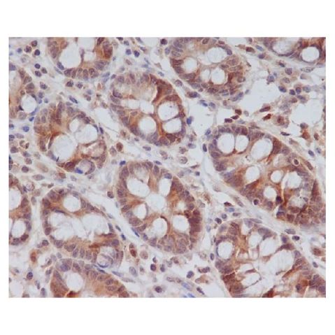 aladdin 阿拉丁 Ab098427 Recombinant Cyclin B2/CCNB2 Antibody Recombinant (R08-1H8); Rabbit anti Human CCNB2 Antibody; WB, IHC; Unconjugated