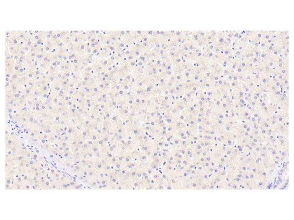 aladdin 阿拉丁 Ab098512 Cyclophilin B Mouse mAb mAb(C1); Mouse anti Human Cyclophilin B Antibody; WB, IHC; Unconjugated
