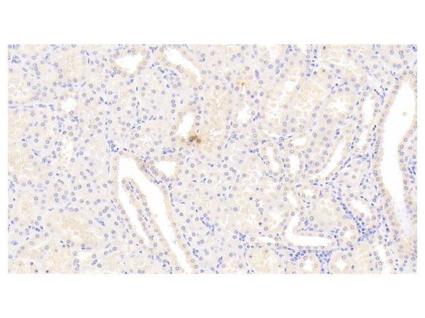 aladdin 阿拉丁 Ab098512 Cyclophilin B Mouse mAb mAb(C1); Mouse anti Human Cyclophilin B Antibody; WB, IHC; Unconjugated