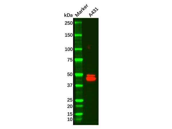 aladdin 阿拉丁 Ab098806 Recombinant Cytokeratin 14 Antibody Recombinant (R02-7I6); Rabbit anti Human Cytokeratin 14 Antibody; WB, IHC; Unconjugated