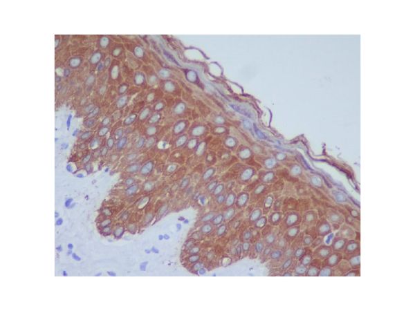 aladdin 阿拉丁 Ab098806 Recombinant Cytokeratin 14 Antibody Recombinant (R02-7I6); Rabbit anti Human Cytokeratin 14 Antibody; WB, IHC; Unconjugated