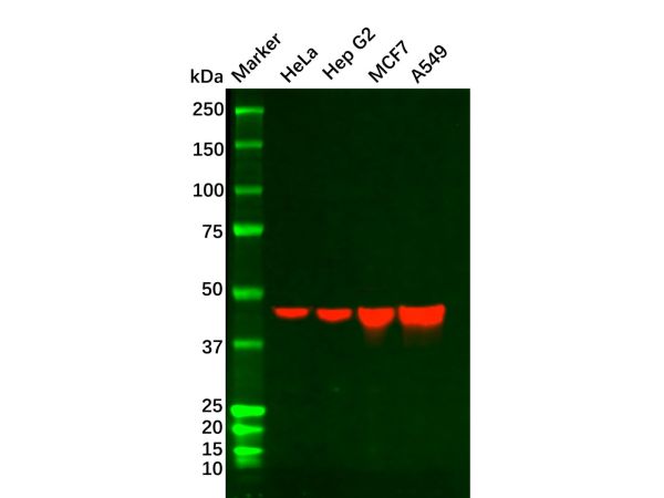 aladdin 阿拉丁 Ab098863 Recombinant Cytokeratin 18 Antibody Recombinant (RR693); Rabbit anti Human Cytokeratin 18 Antibody; WB, IHC, Flow, IF/ICC, IP; Unconjugated