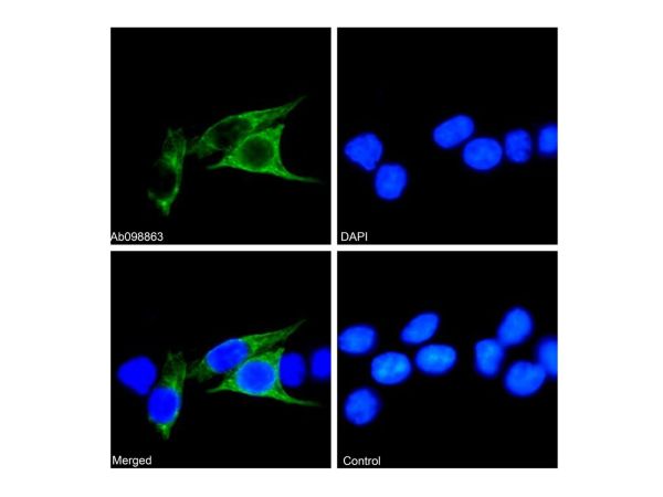 aladdin 阿拉丁 Ab098863 Recombinant Cytokeratin 18 Antibody Recombinant (RR693); Rabbit anti Human Cytokeratin 18 Antibody; WB, IHC, Flow, IF/ICC, IP; Unconjugated