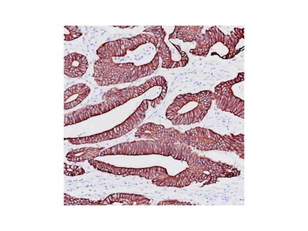 aladdin 阿拉丁 Ab098863 Recombinant Cytokeratin 18 Antibody Recombinant (RR693); Rabbit anti Human Cytokeratin 18 Antibody; WB, IHC, Flow, IF/ICC, IP; Unconjugated