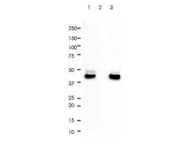 aladdin 阿拉丁 Ab098863 Recombinant Cytokeratin 18 Antibody Recombinant (RR693); Rabbit anti Human Cytokeratin 18 Antibody; WB, IHC, Flow, IF/ICC, IP; Unconjugated