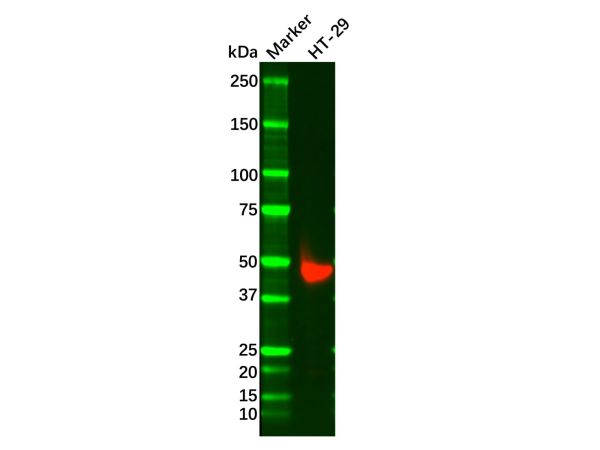 aladdin 阿拉丁 Ab098925 Recombinant Cytokeratin 20 Antibody Recombinant (RR648); Rabbit anti Human Cytokeratin 20 Antibody; WB, IHC, ICC, IF, Flow, IP; Unconjugated
