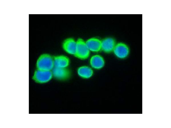 aladdin 阿拉丁 Ab098925 Recombinant Cytokeratin 20 Antibody Recombinant (RR648); Rabbit anti Human Cytokeratin 20 Antibody; WB, IHC, ICC, IF, Flow, IP; Unconjugated