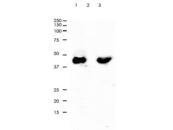 aladdin 阿拉丁 Ab098925 Recombinant Cytokeratin 20 Antibody Recombinant (RR648); Rabbit anti Human Cytokeratin 20 Antibody; WB, IHC, ICC, IF, Flow, IP; Unconjugated