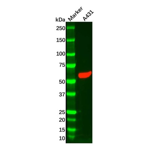 aladdin 阿拉丁 Ab098964 Recombinant Cytokeratin 5 Antibody Recombinant (R04-9H4); Rabbit anti Human Cytokeratin 5 Antibody; WB, IHC; Unconjugated