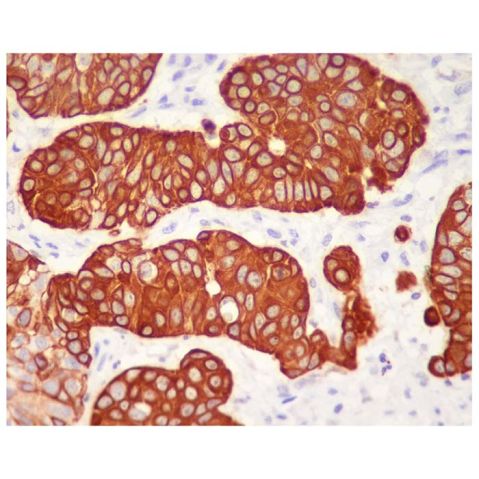 aladdin 阿拉丁 Ab098964 Recombinant Cytokeratin 5 Antibody Recombinant (R04-9H4); Rabbit anti Human Cytokeratin 5 Antibody; WB, IHC; Unconjugated