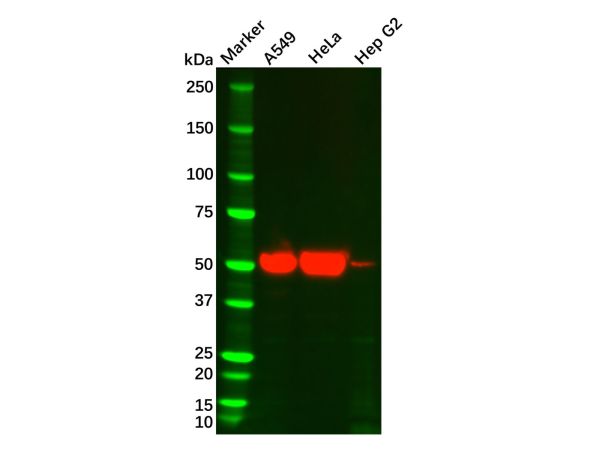 aladdin 阿拉丁 Ab099003 Cytokeratin 7 Mouse mAb mAb (C2); Mouse anti Human Cytokeratin 7 Antibody; WB; Unconjugated