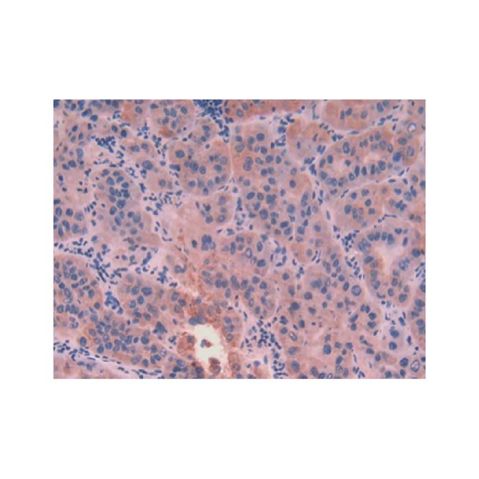aladdin 阿拉丁 Ab099041 Cytokeratin 8 Antibody pAb; Rabbit anti Human Cytokeratin 8 Antibody; WB, IHC, ICC, IF; Unconjugated