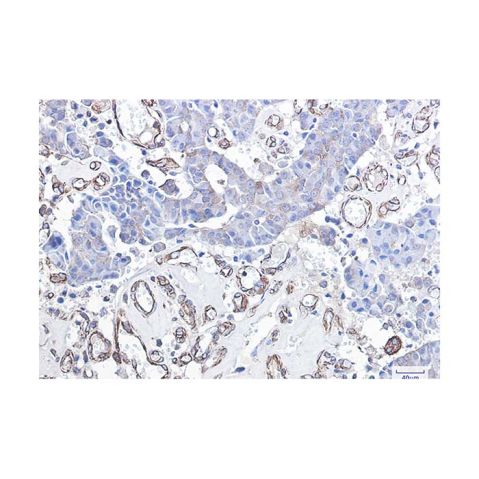 aladdin 阿拉丁 Ab099377 Recombinant DDIT3 Antibody Recombinant (R02-6A3); Rabbit anti Human DDIT3 Antibody; WB, IHC; Unconjugated