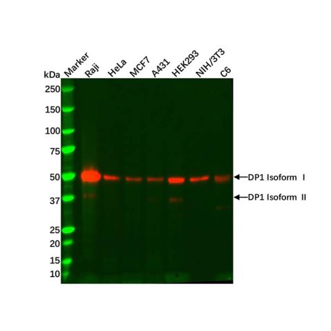 aladdin 阿拉丁 Ab100357 Recombinant DP1 Antibody Recombinant (R03-1T2); Rabbit anti Human DP1 Antibody; WB; Unconjugated