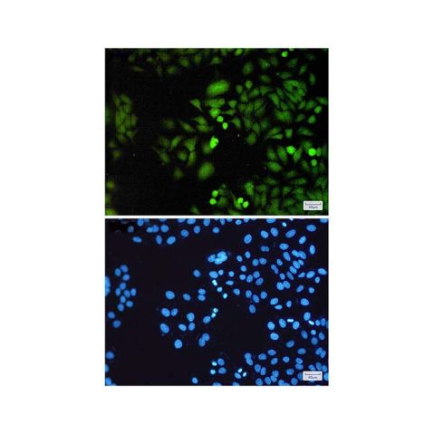 aladdin 阿拉丁 Ab100596 DUSP3 Antibody pAb; Rabbit anti Human DUSP3 Antibody; WB, IHC, IF, ICC; Unconjugated