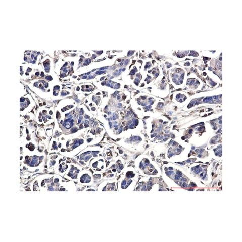 aladdin 阿拉丁 Ab100596 DUSP3 Antibody pAb; Rabbit anti Human DUSP3 Antibody; WB, IHC, IF, ICC; Unconjugated