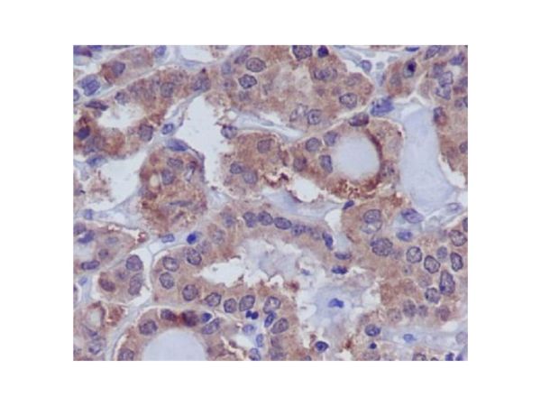 aladdin 阿拉丁 Ab100604 Recombinant DUSP6 Antibody Recombinant (R07-6C1); Rabbit anti Human DUSP6 Antibody; WB, IHC; Unconjugated