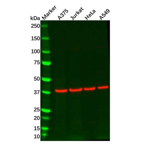 aladdin 阿拉丁 Ab100952 Recombinant EDG2/LPA-1 Antibody Recombinant (R02-5G9); Rabbit anti Human EDG2/LPA-1 Antibody; WB; Unconjugated
