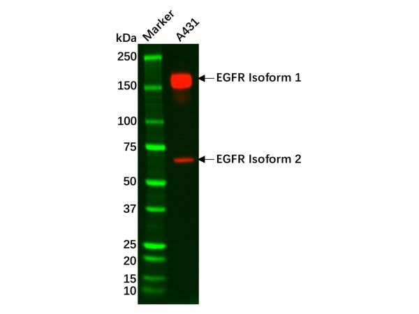 aladdin 阿拉丁 Ab101163 EGFR Mouse mAb mAb(C4); Mouse anti Human EGFR Antibody; WB, IHC; Unconjugated