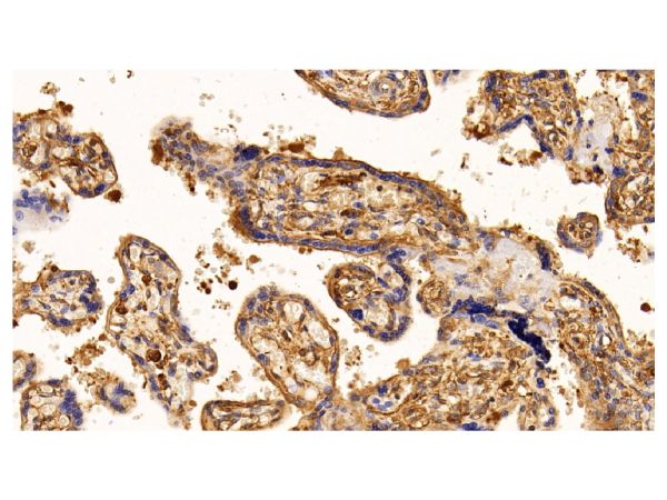 aladdin 阿拉丁 Ab101163 EGFR Mouse mAb mAb(C4); Mouse anti Human EGFR Antibody; WB, IHC; Unconjugated