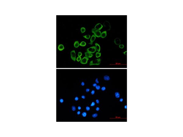 aladdin 阿拉丁 Ab101265 Recombinant eIF2A Antibody Recombinant (R08-8E2); Rabbit anti Human eIF2A Antibody; WB, ICC, IF; Unconjugated