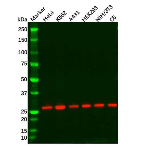 aladdin 阿拉丁 Ab101380 Recombinant eIF4E Antibody Recombinant (R04-4H7); Rabbit anti Human eIF4E Antibody; WB, IHC; Unconjugated
