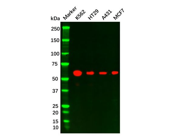 aladdin 阿拉丁 Ab101502 Recombinant ELK1 Antibody Recombinant (R06-5J2); Rabbit anti Human ELK1 Antibody; WB, IHC; Unconjugated