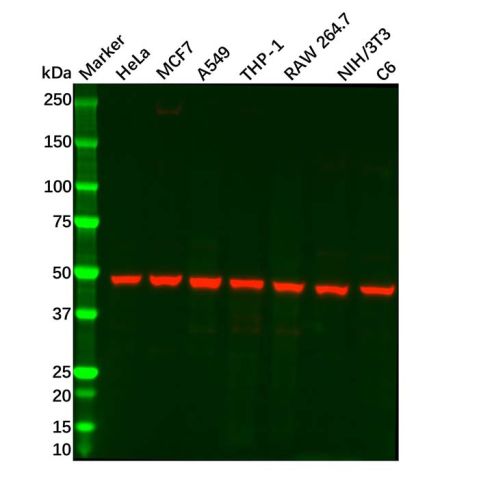 aladdin 阿拉丁 Ab101688 ENO1 Mouse mAb mAb (C2); Mouse anti Human ENO1 Antibody; WB, IHC; Unconjugated
