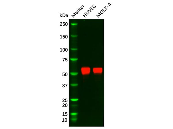 aladdin 阿拉丁 Ab102175 Recombinant ERG Antibody Recombinant (R09-9J7); Rabbit anti Human ERG Antibody; WB, IHC; Unconjugated