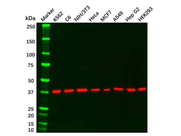 aladdin 阿拉丁 Ab102233 Recombinant ERK2 Antibody Recombinant (R07-1A9); Rabbit anti Human ERK2 Antibody; WB, IHC, IF, ICC; Unconjugated