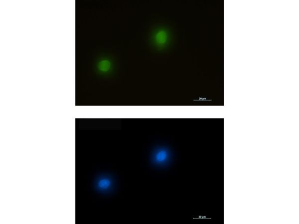 aladdin 阿拉丁 Ab102233 Recombinant ERK2 Antibody Recombinant (R07-1A9); Rabbit anti Human ERK2 Antibody; WB, IHC, IF, ICC; Unconjugated